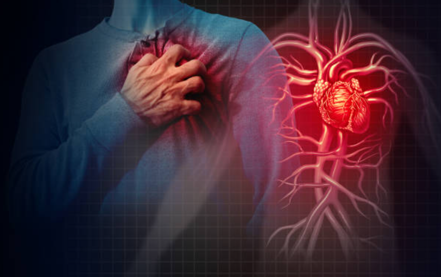 Хронічна ішемічна хвороба серця: стратегії лікування та управління