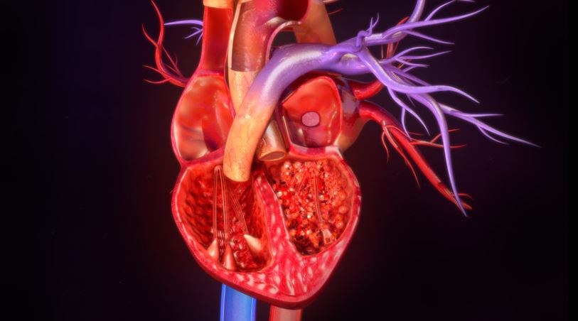 Розшаровуюча аневризма аорти – небезпечний стан великої судини