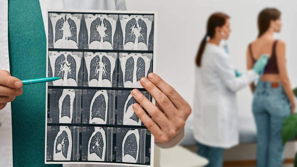 КТ легень у Києві: для чого призначається та як підготуватись